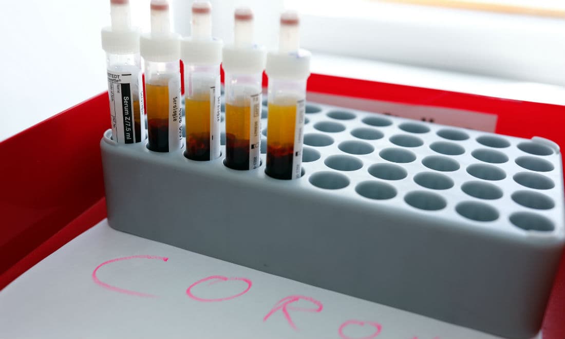 Myndighederne er gået fra at teste få til nu at ville teste over 15.000 mennesker om dagen for coronavirus. 